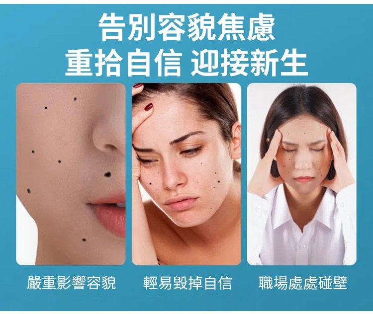 黃輔堂點痣膏